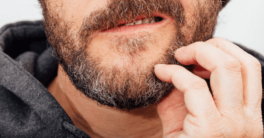 dermatite barba
